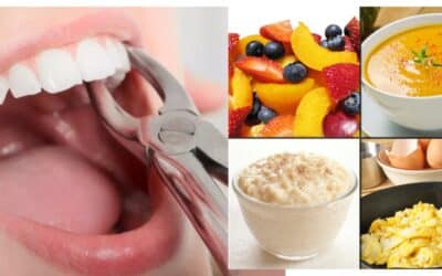 What to Eat After Tooth Extraction?