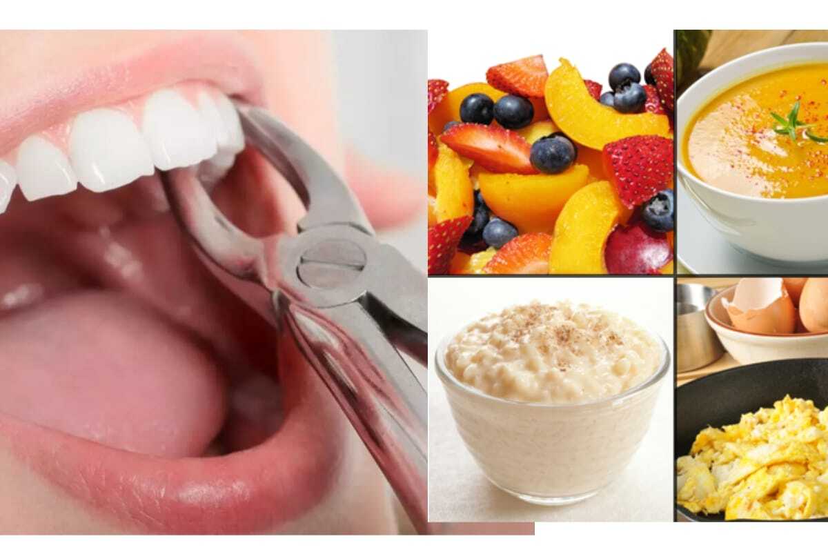 Soft foods recommended after tooth extraction including fresh fruits, soup, mashed potatoes, and scrambled eggs.