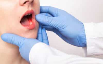 Science Behind Sinus Graft: How Do They Support Dental Implants
