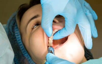What Benefits Do Tooth Extraction Have Over Root Canals?