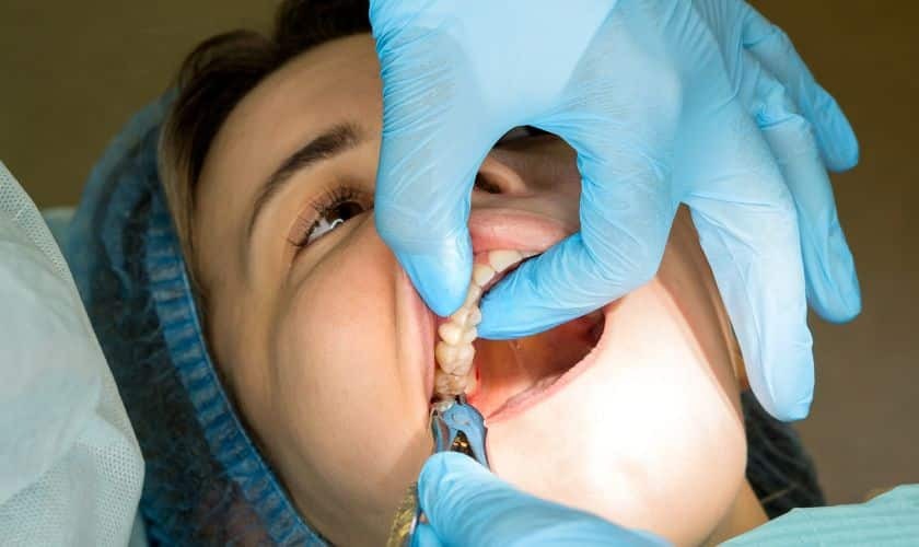 Tooth Extraction in Phoenix (1) Dentist examining patient's teeth during oral evaluation in Phoenix dental office.