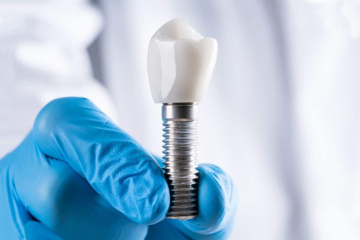 Dental implant with white ceramic crown held by gloved hand in Phoenix dental office.