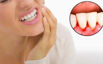 How to Treat Periodontal Disease: Everything You Should Know