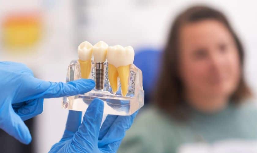 Dentist displaying dental implant model with natural teeth and metal implant posts to patient.