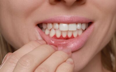 Periodontal Cleaning: Tips to Keep Your Gums Healthy