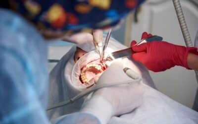 How Effective is Osseous Surgery for Treating Gum Disease?