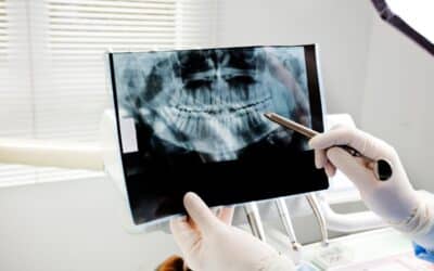 Understanding the Safety of Dental X-Rays and CT Scans: Are They Harmful?
