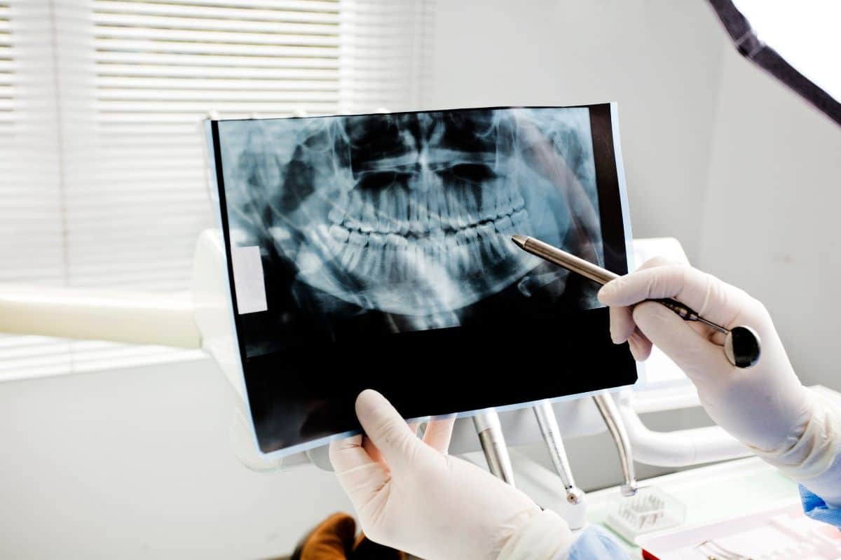 Understanding the Safety of Dental X-Rays and CT Scans Are They Harmful Dentist examining panoramic dental X-ray of patient's teeth and jaw structure.