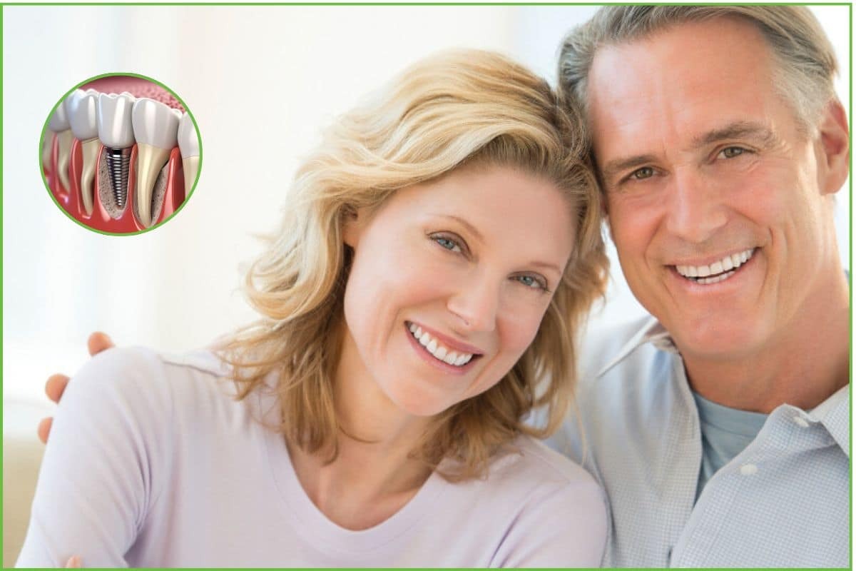 Dental Implant Care How to Look After Your Implants Smiling couple displaying healthy teeth and dental implant diagram showing tooth replacement structure.