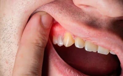 How Gum Disease Affects More Than Just Your Mouth