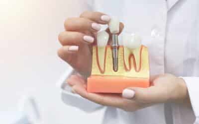 Book Your Consultation for Anterior Implant and Healing Cap Placement