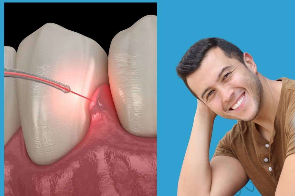 LANAP laser gum surgery diagram showing laser treatment of inflamed gum tissue between teeth in Phoenix.