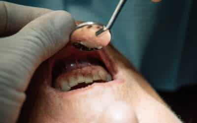 Best Oral Care Habits to Protect Against Gum Disease