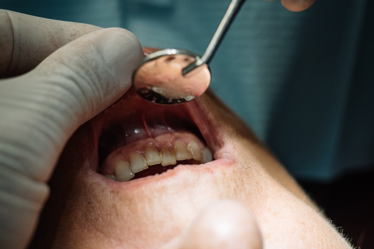 Dentist examining patient's teeth during gum disease prevention checkup.