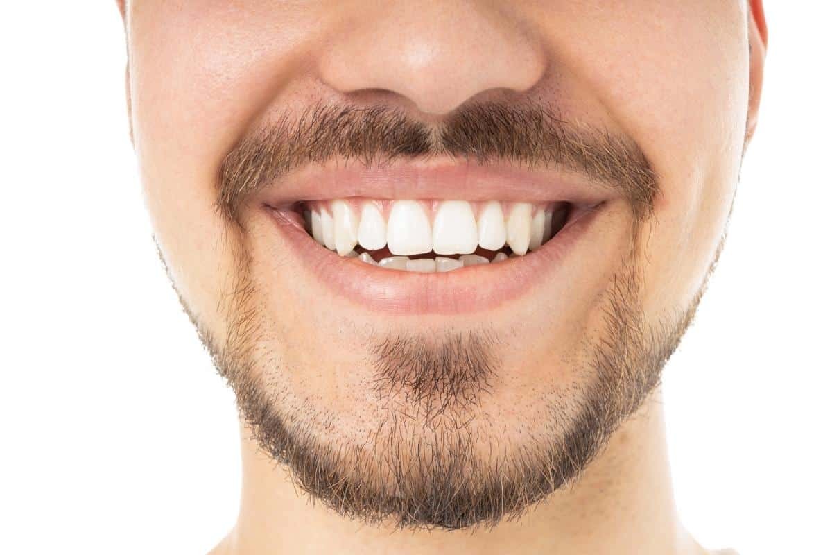 How Ridge Augmentation Improves Your Smile and Oral Health Man with full beard and mustache displaying bright white teeth in a confident smile.