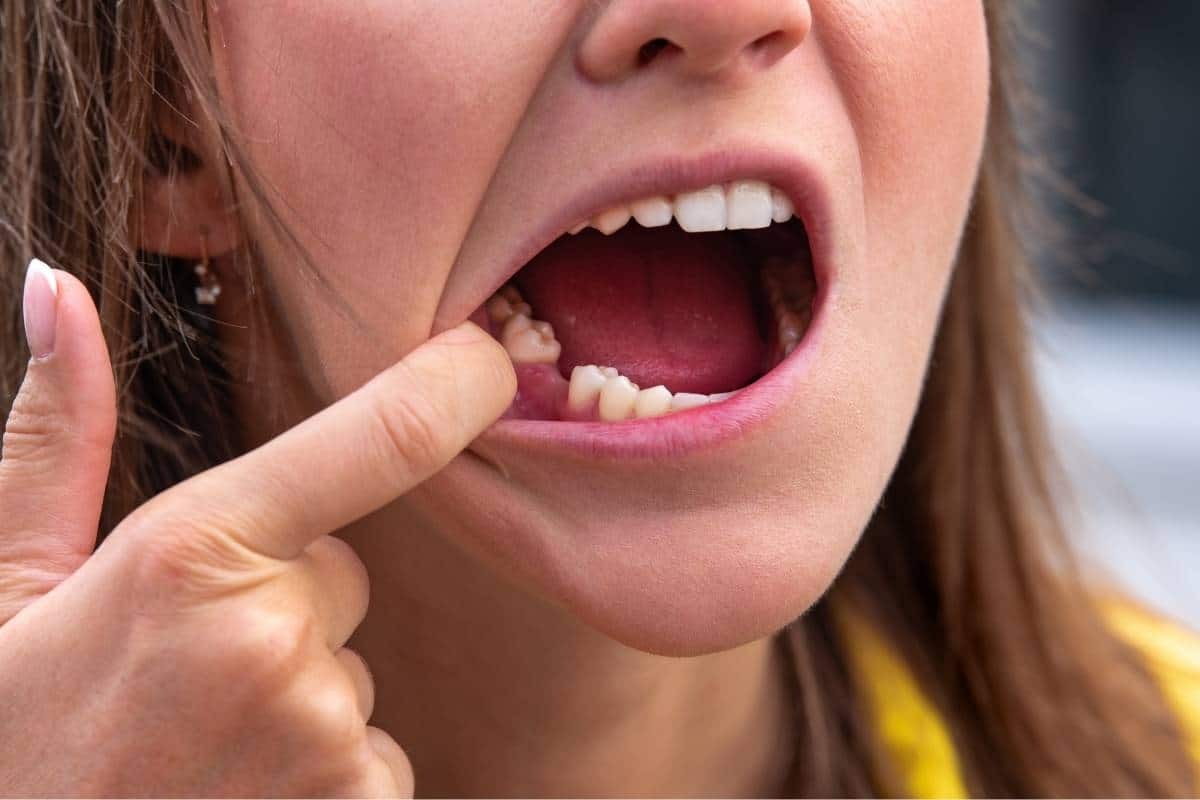 Child pointing to missing baby tooth in mouth during dental examination.