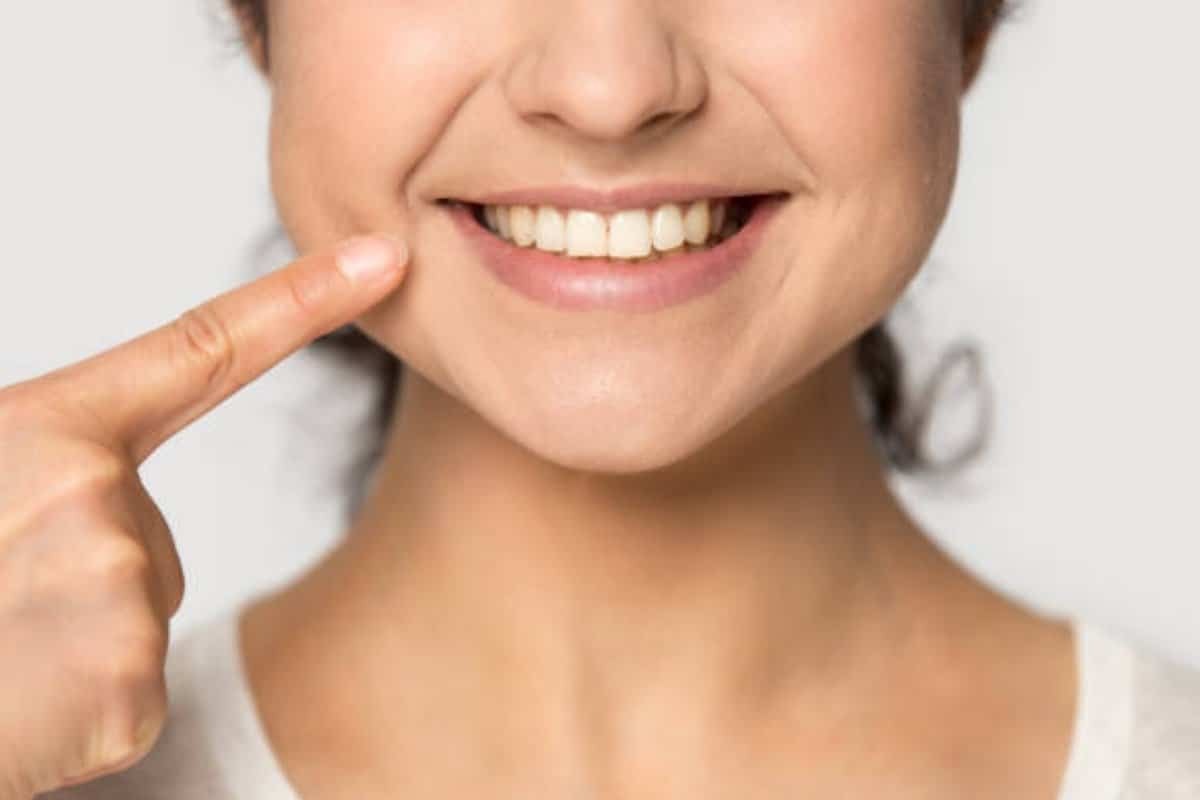 Pinhole Gum Rejuvenation A Modern Solution for Receding Gums Woman smiling while pointing to her gums, demonstrating healthy gum tissue after treatment.