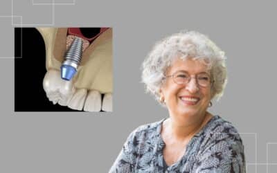 Missing Upper Back Teeth? How Sinus Grafting Creates a Strong Foundation for Dental Implants