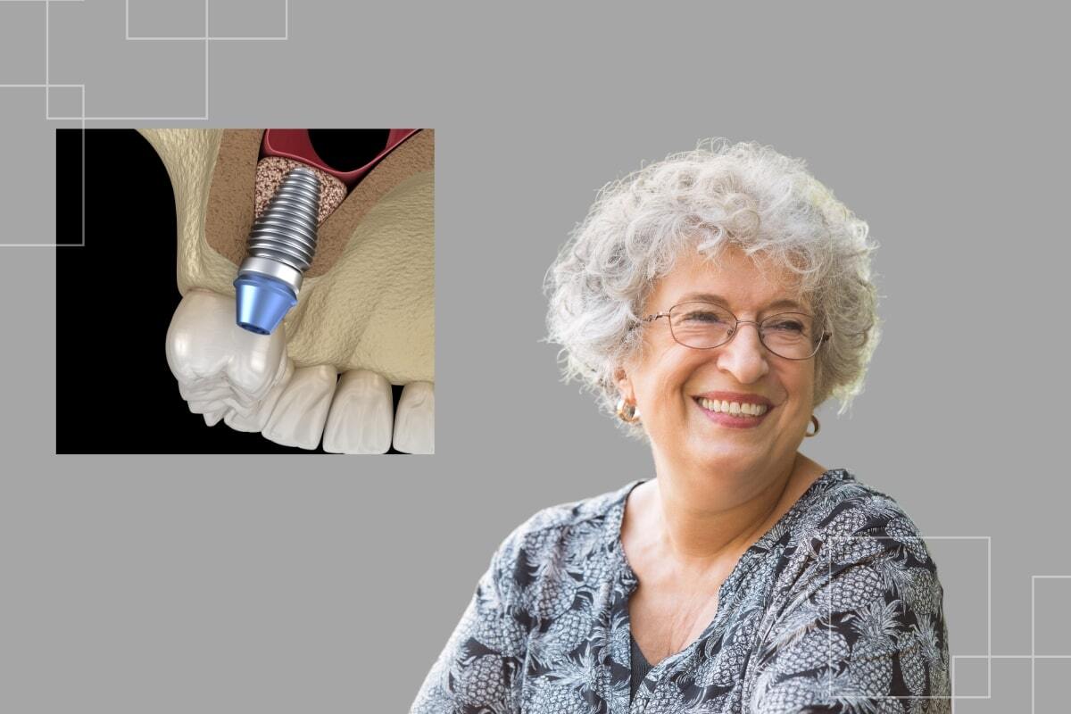 Sinus Grafting for Dental Implants Restoring Bone in the Upper Jaw Dentist holding dental implant component during sinus grafting procedure consultation.
