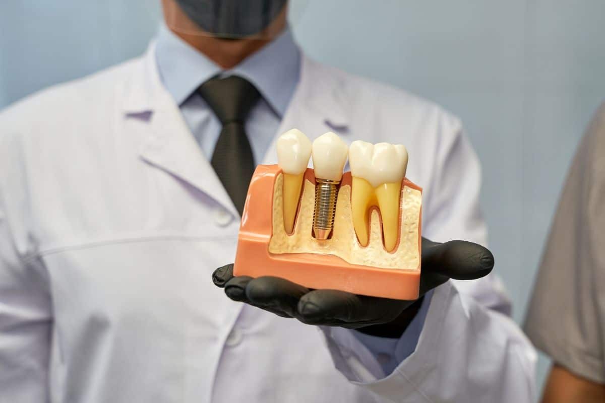 Dentist holding dental implant model showing sinus lift and bone graft procedure in Phoenix.