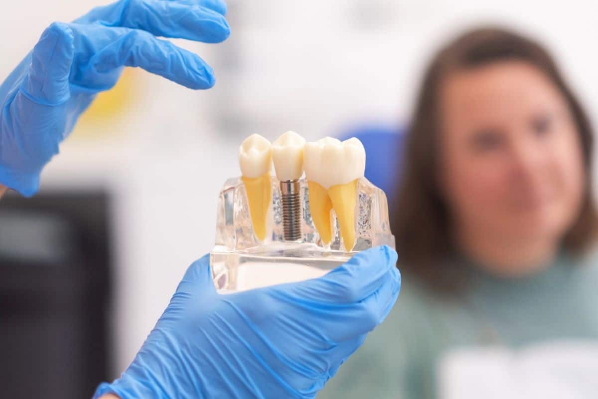 Dental implant model showing natural tooth, implant fixture, and crown restoration held by dentist.