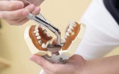 Tooth Extraction and Its Impact on Jawbone Health