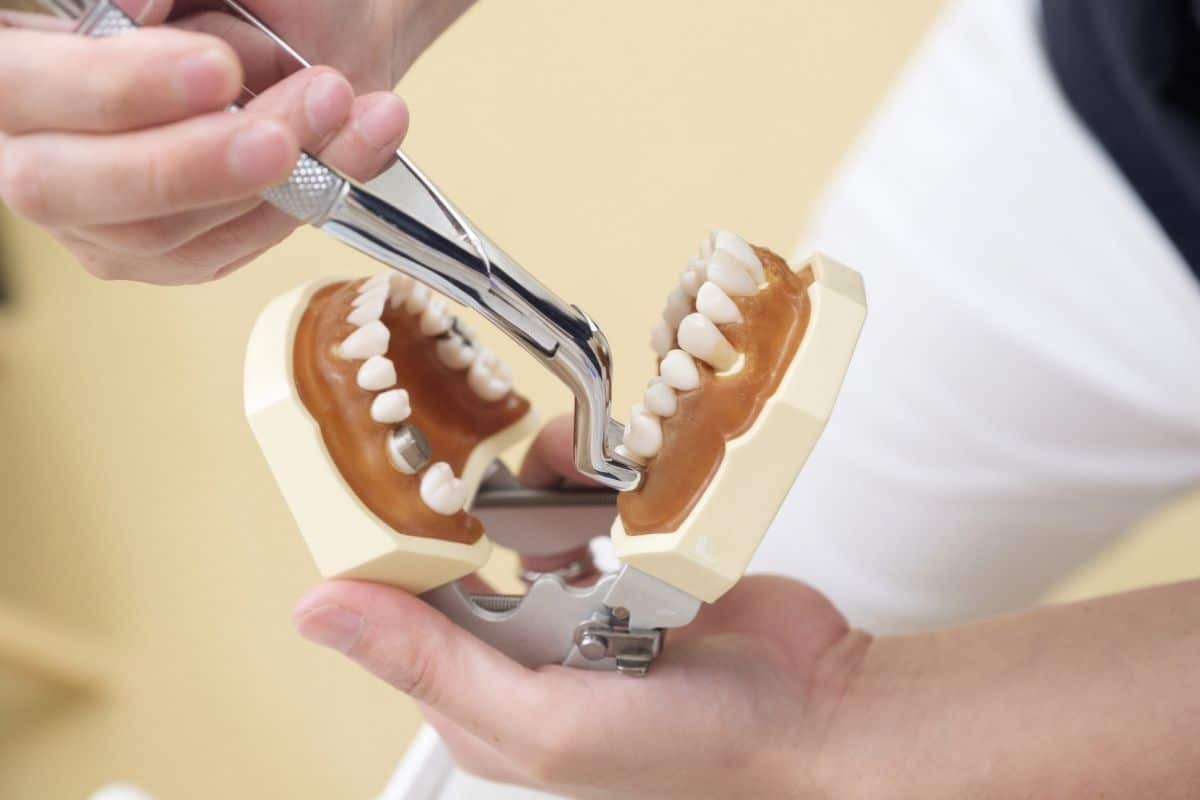 Dentist demonstrating tooth extraction effects on jawbone using dental model and instruments.