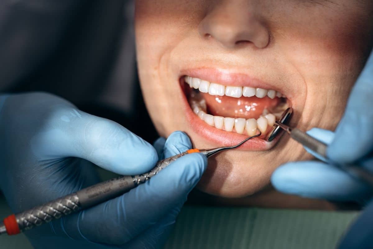 Dentist performing gum graft procedure on patient's lower teeth in Phoenix.