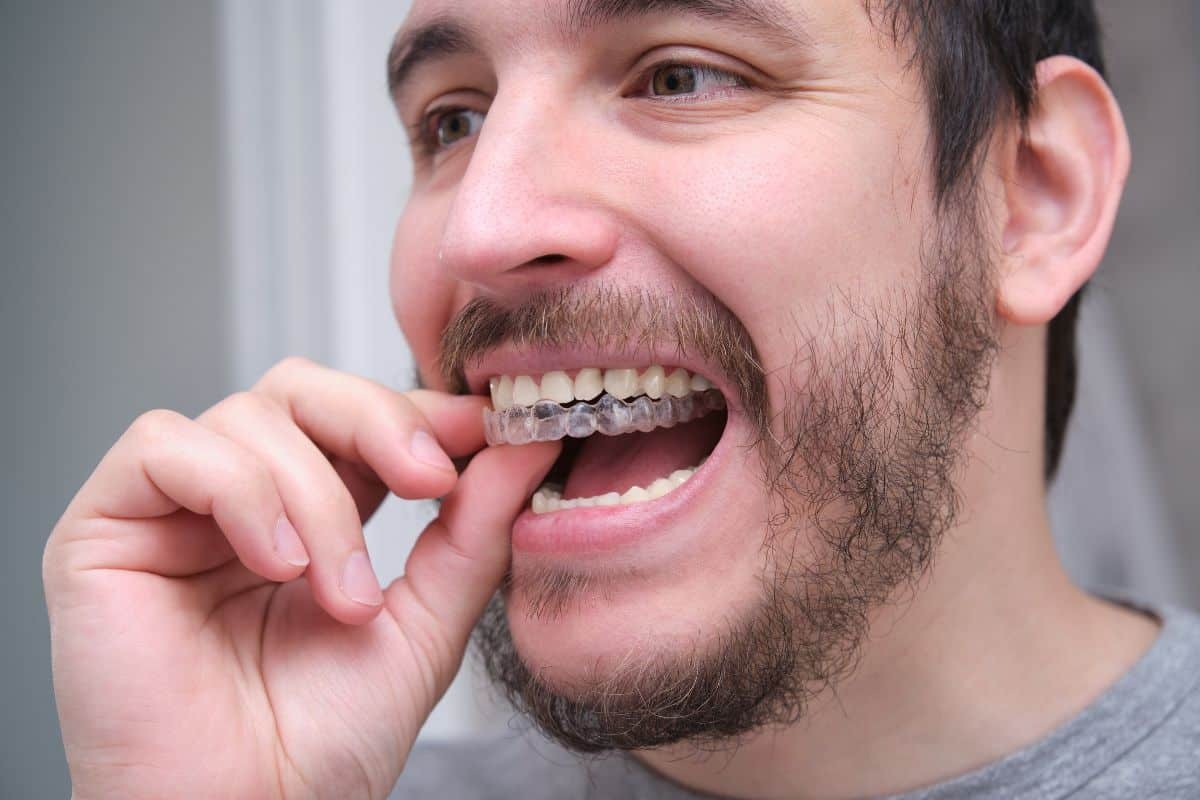 Man inserting clear aligner into mouth to demonstrate occlusion therapy treatment.