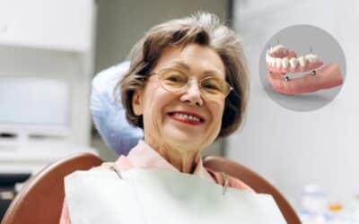 Full Arch Implants Recovery Timeline: Week-by-Week Healing Guide