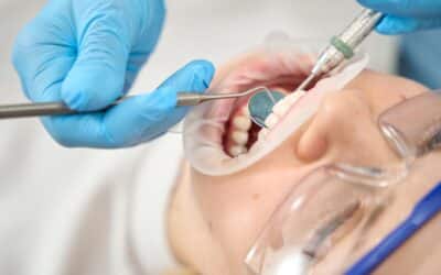 How Frequently Should You Get Scaling and Root Planing? Expert Oral Health Advice
